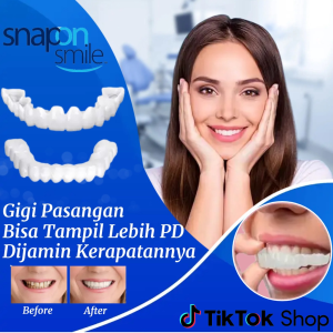 Original 1 set Snap On Smile Gigi Palsu Atas Bawah Pria Wanita Snap on Smile Veneers Gigi Perfect Smile Gigi Tiruan