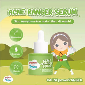 𝗝𝗨𝗡𝗞𝗜𝗘 𝗠𝗔𝗞𝗘𝗨𝗣 -Pigeon Teens Serum Acne serum Bright & Hydra Squad Serum