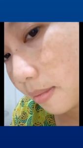 Gold Series Daviena Skincare | Daviena Gold Series