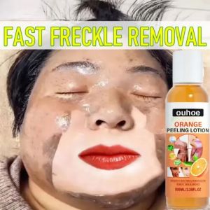Orange Peeling Lotion: A Natural Skin Treatment for Blemish Removal & Whitening