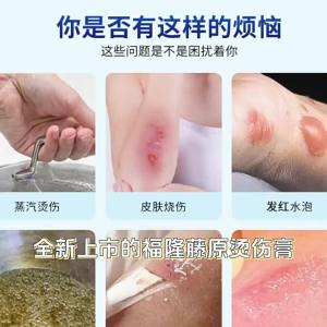 324 Fulong Fujiwara Burn Cream Steam Burn Skin Burn Blister Burn Scar External Use Health Cream Wholesale