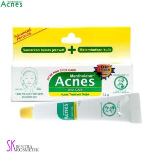 ACNES Spot Care 12 gr Mengatasi Noda Bekas Jerawat