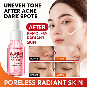 377 Whitening and Anti-Blemish Essence Whitening Essence Moisturizing Essence Lightens Dark Spots Brightens Skin Brightens Dull Skin