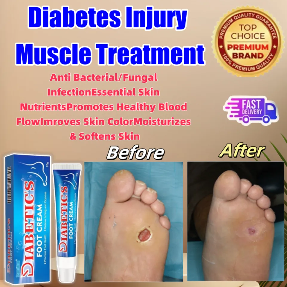 SUMIFUN diabetic wound ointment diabetic wound healing ointment
