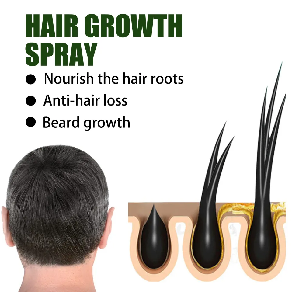 Cách khắc phục tóc xoăn cho nam giới để tạo kiểu dễ dàng hơn