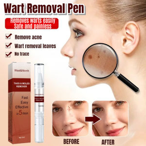 Wart Pen Wart Repair Solution/Fast Effective Herbal Peeling/Daily Care For All Ages Men Women/Skin Tag Mole Repair Smooth Skin