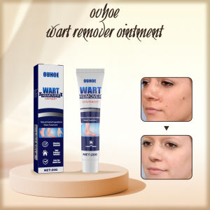 Ouhoe Wart Remover Ointment Remover Extract Corn Plaster Wart Ointment Remover Mole And Warts Remover Warts Flat Warts 20g