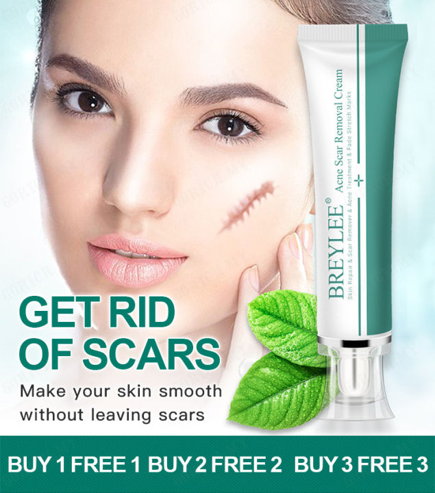 BREYLEE Acne Scar Removal Cream Repair Stretch Marks Pimple Marks Skin Care