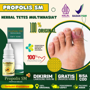 Obat Jamur Kuku dan Cantengan Obat Penumbuh Kuku Obat Kuku Rusak Bernanah Cantengan Berjamur Kuning Bau Busuk - Herbal Alami ProPolis SM