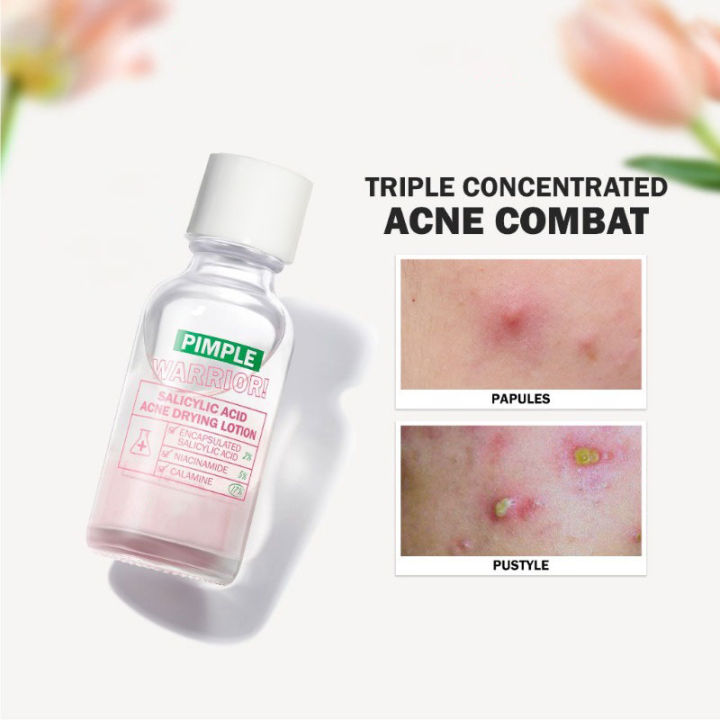 Pimple Warrior! Salicylic Acid Acne Drying Lotion - Acne Spot Treatment ...