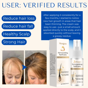 Hair Follicle Nourishing Stock Solution--hair Growth And Hair Strengthening Female Hairline Spray Hair Care Scalp Essence Nutrient Solution 滋养密发育发液喷雾