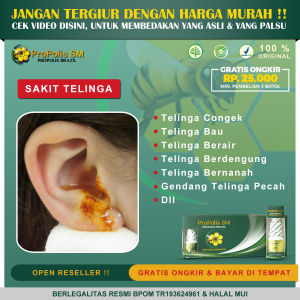 Obat Telinga Bocor Gangguan Pendengaran Telinga Berair Congek Gendang Telinga Pecah dengan Propolis SM sudah BPOM & Halal MUI