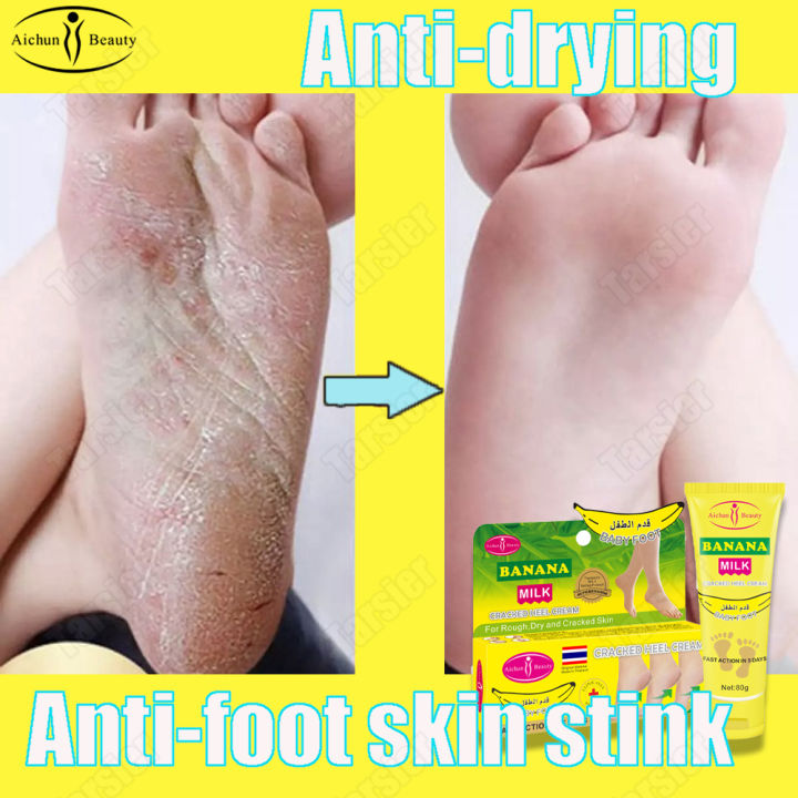 Authentic Aichun Foot Care Cream Foot Peeling Cracked Hands Hand