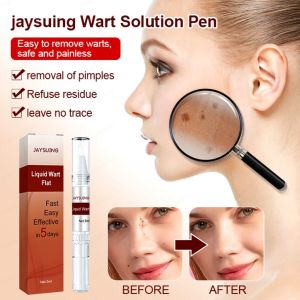 【COD】Wart removal liquid pen  Mole removal care pen Skin Tag Removal Pen Meat thorn mole removal pen