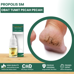 Obat Tumit Kaki Pecah Pecah Obat Telapak Kaki Kering Telapak Kaki Pecah Pecah Obat Kaki Pecah Dan Kasar Obat Kaki Sakit Obat Kaki Perih Dengan Propolis SM