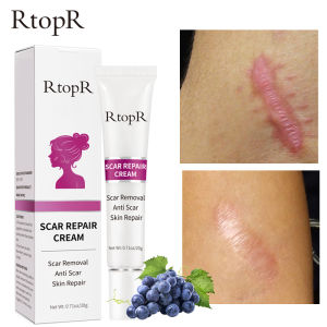 RtopR Scar Remover Gel Stretch Marks Remover Repair Cream Acne Treatment Whitening Moisturizer Serum Skin Care