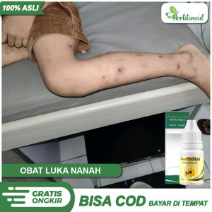 Obat Luka Nanah Kaki - Obat Diabetes - Obat Gatal Cenang Berair - Penghilang Koreng Hitam - Propolis Sm