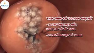 Túi Lọc Thảo Dược Xông Rửa Phụ Khoa - Cụ Lang Tị - Giảm Ngứa Khử Mùi. Chống Khí Hư Làm Hồng Se Khít - bịch 20 túi