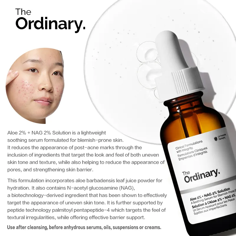 the ordinary Aloe 2%+NAG 2% Solution serum Relieve acne fade acne marks  shrink pores skin hydration Repair skin barrier | Lazada PH