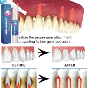 Gum Protect Repair Gels Gum Protection And Repair Gel Strengthening Teeth Nourish Restore Gums Teeth Care Gels