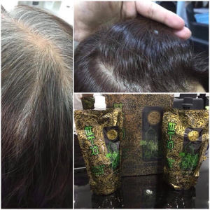 Thuốc Nhuộm đen Hàn Quốc HD mùi cafe không dính da đầu 420ml x2