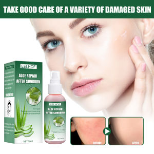 Eelhoe Aloe Vera Essence Repair Sunburn Sensitive Skin Improve Rough Skin Aloe Vera Spray Moisturizing Sooth Skin Face Care(50ml)