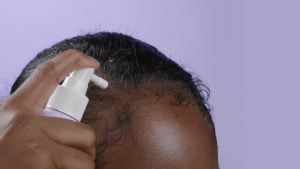 Dr.Rosemary Mint Oil Tonic for Hair Growth with Biotin Hyaluronic Acid Thickening & Scalp Nourishing. Korean Haircare. Sulfate-Free Silicon-Free Paraben-Free (3.38 fl oz/ 100ml)