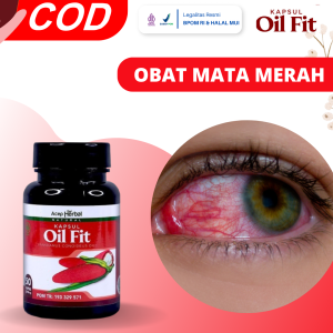 Obat Mata Merah Obat Mata Merah Parah Obat Radang Mata Obat Menghilangkan Mata Merah Sebelah Obat Mata Berwarna Merah Iritasi Obat Penyakit Mata Merah Berair Terus Menerus Mata Perih Dan Sakit Dengan Oil Fit