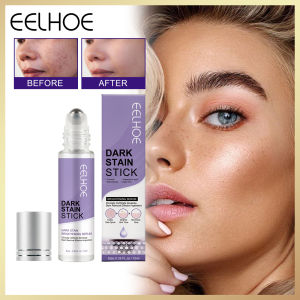 Eelhoe Dark Stain Stick Spot Repair Skin Repair Lightening Skin Blemish Melasma Melanin Hydrating Black Spot Remover Dark Spot Lightening Serum Remove Chloasma Improve Melanin Moisturize Fade Pigmentation Brighten Stain Whitening Freckle Essence