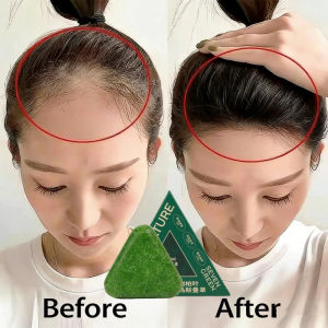 SG Ready Stock Triangle Herbal Shampoo Soap Anti Dandruff Oil Control Nutritious Scalp Cleaning Hair Care Bar