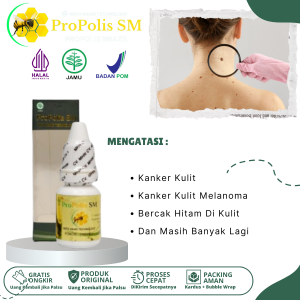 Obat Kanker Kulit Herbal Kanker Kulit Obat Kanker Kulit Melanoma Obat Kanker Kulit Di Tangan Dan Kaki Obat Penghilang Kanker Kulit Melanoma Salep Penghilang Bekas Luka Kanker Kulit Obat Benjolan Bercak Hitam Di Kulit Dengan Propolis SM