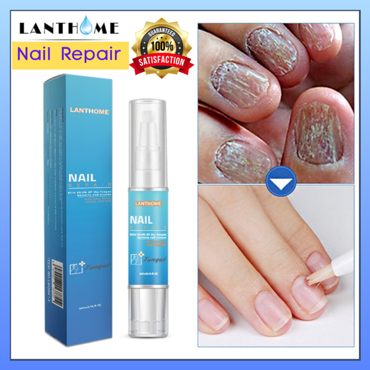 Lanthome Nail Repair Care Solution Herbal antibacterial treatment of Onychomycosis Paronychia
