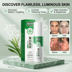 Whitening Dark Spot Serum Brightening Skin Essence Fade Dark Spots Radiant Complexion