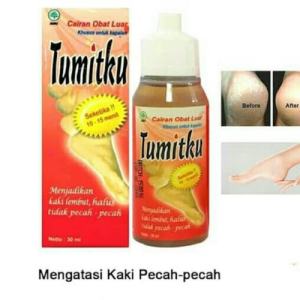Obat Cairan Herbal Tumit Pecah Kaki Badak Kering Tumitku Penghalus Obat Kaki Tumit Pecah Pecah Kering Kapalan Asli Terbukti Ampuh Tumitku 100% Bpom