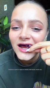 New Hismile V34 Teeth Whitening Strips Whitening Strips Purple Tooth Whitening Tooth Stain Treatment