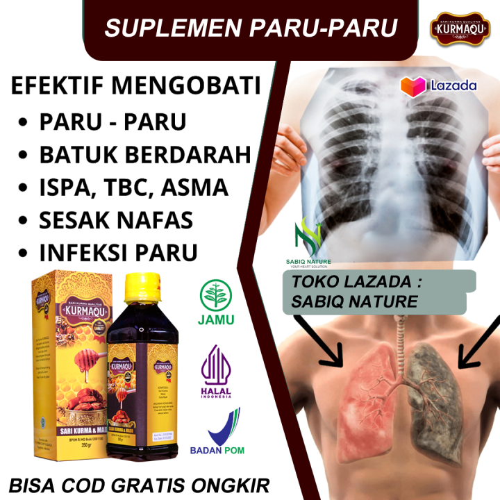 Obat Flek Paru Paru Anak Dewasa Tb Paru Radang Tenggorokan Sesak Nafas ...