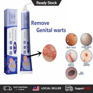 Wart Remover Ointment Wart Removal Cream Genital Wart Removal Cream Mole Skin Tag Remover Mole Mole Repellent