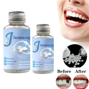 LKMART Denture Adhesive Glue Repair Dental False Teeth Solid Glue Decorative Denture Temporary Tooth Filling Material Tooth Repair Kit Tooth Replacement Material Denture Solid Tooth Gel