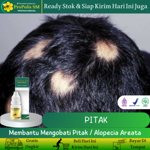 Propolis SM - Obat Penumbuh Rambut Botak Obat Pitak Obat Alopecia Areata Botak Koin