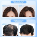 Hair Care Essence Roll-On Anti Hair Loss Serum with Scalp Massage Roller Improve Hair Growth Nourishing Repairing Damaged Hair. 