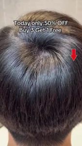 【NO.1】Dr.ville Hair Tonic Rambut Gugur Hair Growth Spray for Thinning Hair Treatment Effective 50ml