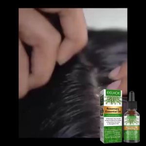 FCEelhoe Rosemary Hair Growth Essential Oil Anti Hair Loss Fast Regrowth Essence Aromatherapy Repair Damaged Frizzy Thinning Scalp Hair-restorer Dense Hair Growth Serum
