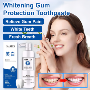 【MARTES】Whitening And Stain-removing Toothpaste/stain-removing And Gum-protecting Toothpaste/push-on Type 美白去渍牙膏