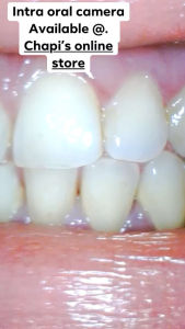 ⚡️Intraoral camera⚡️8 led light actual video been posted