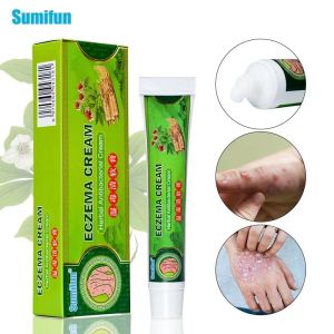 【Sumifun】Eczema Treatment Cream gamot sa kati kati sa balat buni Psoriasis Treatment Cream Eczema Ointment for Itchy Skin and Allergy Antibacterial Fungisol Antifungal Cream Anti Itch Cream for Skin Herbal Cream fungisol antifungal gamot sa buni(20g)