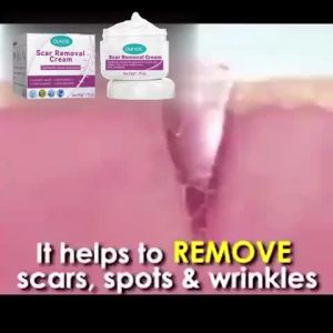 Scar Removal Cream Repair Old Scar Remover Acne Treatment Scar Surgical Scars Stretch Marks Remover Cream