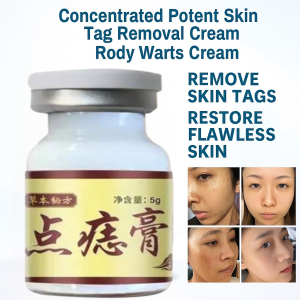Wart Removal Cream Painless Wart Remover Cream No Skin Damage Mole Remover No Scars Skin Tags Remover