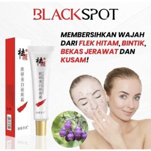 Cindynal Dark Spots Penghilang Flek Hitam Membandel Whitening Freckle Cream Remove Dark Spots Anti Freckle/Bintik noda/ Jerawat