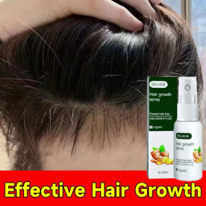 Xịt Mọc Tóc Dưỡng Tóc Tinh Gừng Tươi Kích Phục Hồi Hư Tổn Giảm Gãy Rụng Và Kích Thích Mọc Tóc 20ml