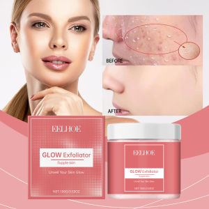 Eelhoe Làm Trắng Mặt Chà Tẩy Tế Bào Chết làm sáng da Glow Exfoliator Mặt Scrub 100G